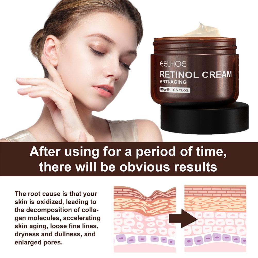 EELHOE 1/2/3/5PCS (Achetez 3,  - Retinol Anti Wrinkle Cream avis et prix