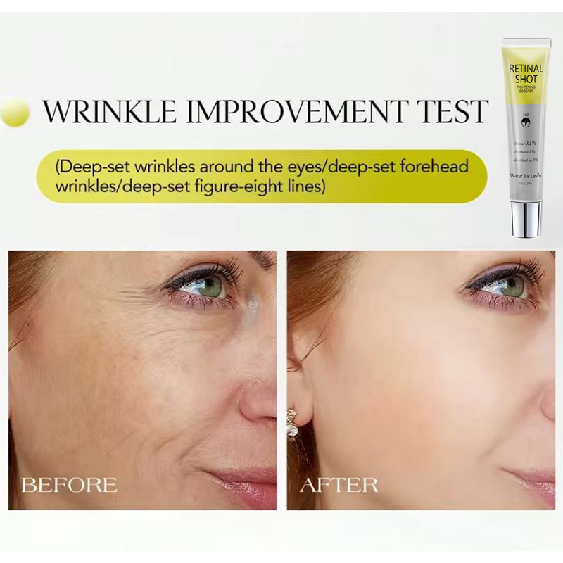 Soin intensif pour la rétine 0 - Retinol Anti Wrinkle Cream avis et prix