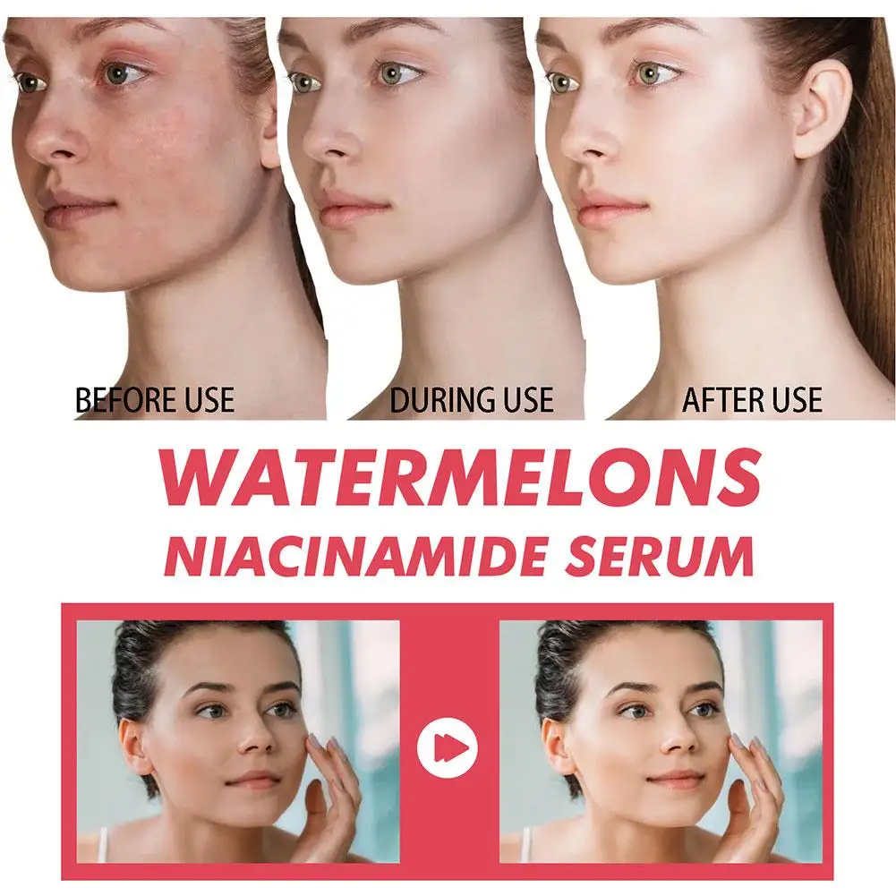 Sérum hydratant à la pastèque  - Hyaluronic Acid Facial Serum avis et prix